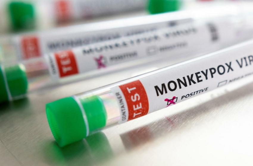  ONU repudia a estigmatização de varíola de macacos como doença gay: “Qualquer um pode pegar”