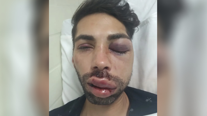 Jovem é brutalmente espancado na saída de boate no interior de SP e denuncia homofobia