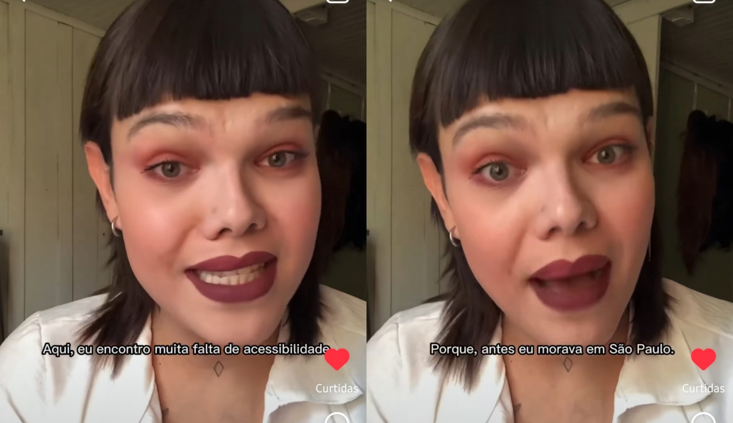 Trans perde perna após câncer e faz apelo: “preciso de uma scooter para trabalhar”