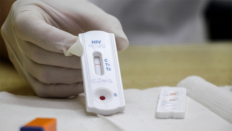  Farmácias de todo o país poderão aplicar testes para HIV, sífilis e hepatite a partir desta terça