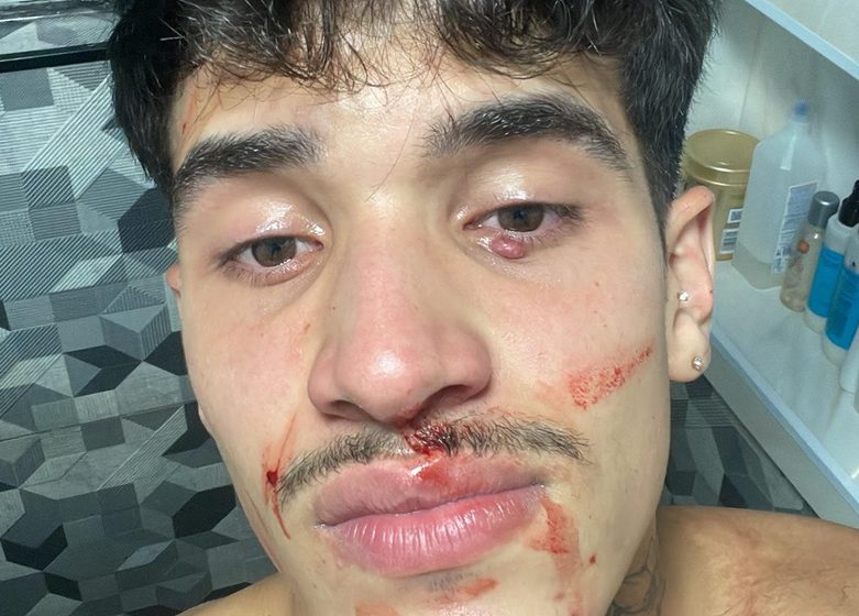  Jovem é agredido por homofóbicos dentro do metrô de São Paulo: “Um deles me segurou e o outro esmurrou”