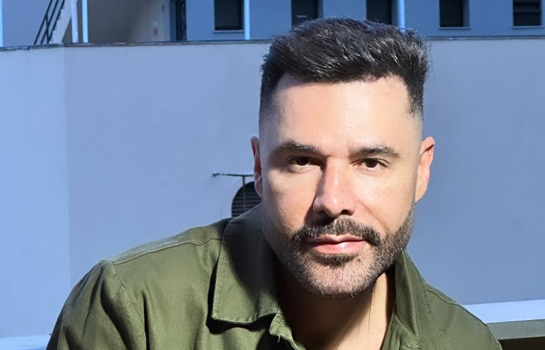 Rodrigo Sant’anna lamenta ataques após harmonização facial: “Queria ter a cara quadrada”