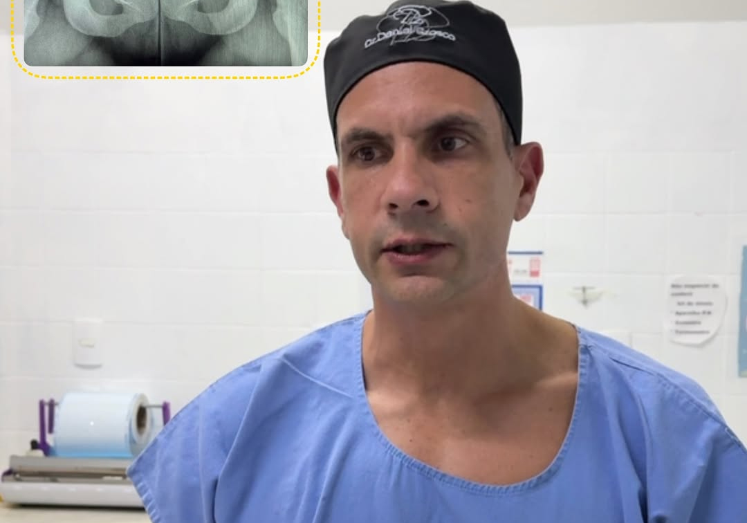 Proctologista faz alerta urgente sobre plugs anais: “Perfuração do reto pode levar à morte”