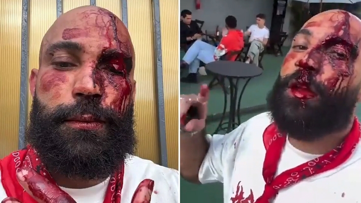  Cliente acusa segurança de agressão após confusão em balda LGBTQIAPN+  de Goiânia
