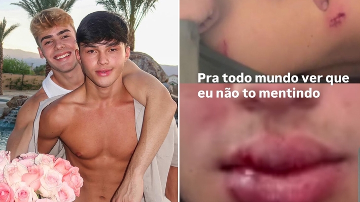  Mãe do influenciador Luan Alencar diz que filho foi agredido pelo namorado em Paris: “Ele desmaiou”