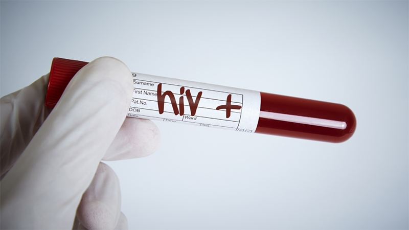  Casos de HIV aumentam no Rio; pesquisa aponta maior concentração na Zona Oeste