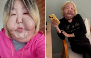 Juju do Pix reaparece nas redes após cirurgia no rosto e mostra avanços na recuperação: “Estou ótima”