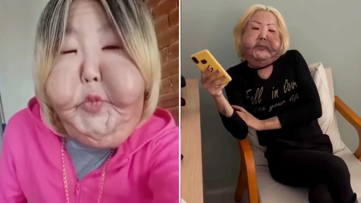  Juju do Pix reaparece nas redes após cirurgia no rosto e mostra avanços na recuperação: “Estou ótima”