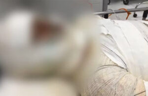 Adolescente trans de 13 anos é agredida e queimada viva no ES; família suspeita de transfobia