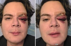 Homem invade apartamento, agride médico e faz ameaças homofóbicas no Recife: “Nunca vi esse cara”