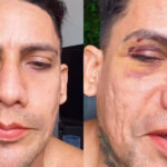 Justiça afasta PMs após denúncia de agressões e homofobia contra casal gay no Carnaval de Salvador