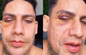 Justiça afasta PMs após denúncia de agressões e homofobia contra casal gay no Carnaval de Salvador