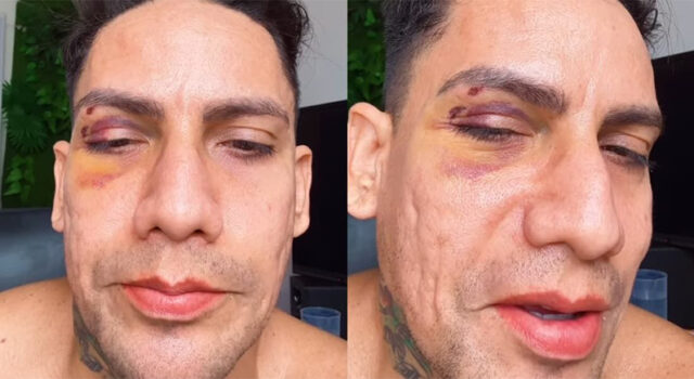 Justiça afasta PMs após denúncia de agressões e homofobia contra casal gay no Carnaval de Salvador