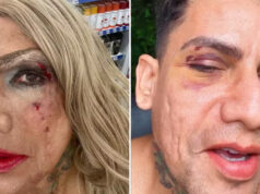 Montado de drag queen, arquiteto denuncia homofobia após ser xingado e agredido no Carnaval de Olinda