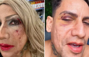 Montado de drag queen, arquiteto denuncia homofobia após ser xingado e agredido no Carnaval de Olinda