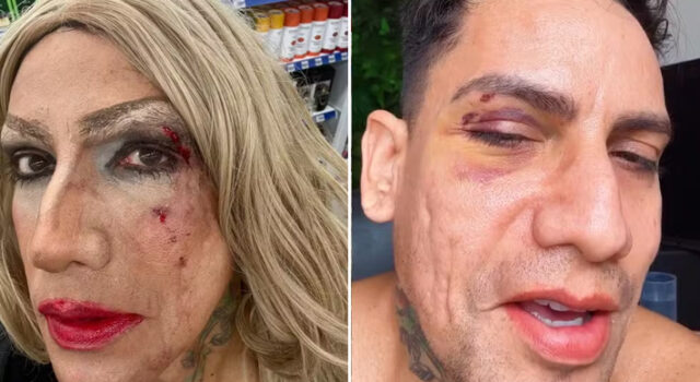Montado de drag queen, arquiteto denuncia homofobia após ser xingado e agredido no Carnaval de Olinda