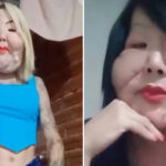 Após retirar óleo mineral do rosto, Juju do Pix mostra resultado e surpreende seguidores