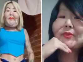 Após retirar óleo mineral do rosto, Juju do Pix mostra resultado e surpreende seguidores