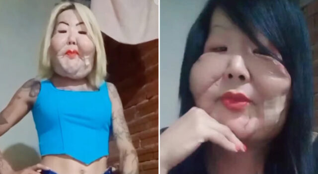 Após retirar óleo mineral do rosto, Juju do Pix mostra resultado e surpreende seguidores