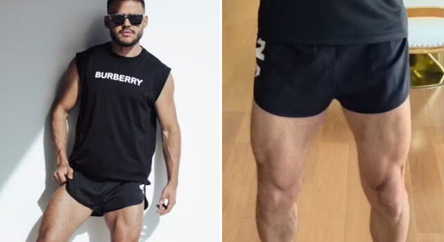 Justiça manda academia indenizar aluno em R$ 20 mil após advertência por short “inadequado”