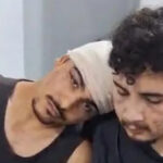 Homofobia: casal gay é brutalmente agredido com pedradas na zona oeste de São Paulo