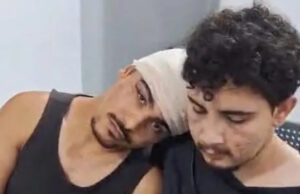 Homofobia: casal gay é brutalmente agredido com pedradas na zona oeste de São Paulo