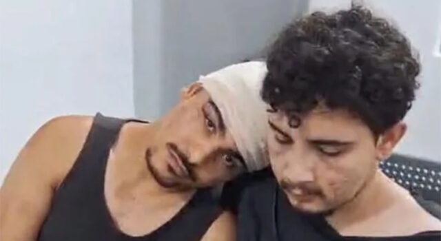 Homofobia: casal gay é brutalmente agredido com pedradas na zona oeste de São Paulo