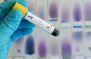 Rio avança no combate ao HIV, aumenta uso da PrEP em 50% e lidera ranking nacional