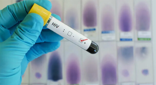 Rio avança no combate ao HIV, aumenta uso da PrEP em 50% e lidera ranking nacional