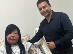 Após retirar óleo mineral do rosto, Juju do Pix realiza sonho de colocar silicone e celebra resultado