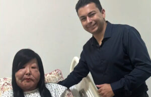 Após retirar óleo mineral do rosto, Juju do Pix realiza sonho de colocar silicone e celebra resultado