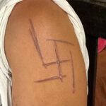 Mulher trans é torturada, ameaçada de morte e marcada com suástica em MS: “Sou marcada por uma maldade humana”