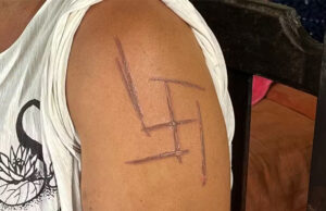 Mulher trans é torturada, ameaçada de morte e marcada com suástica em MS: “Sou marcada por uma maldade humana”