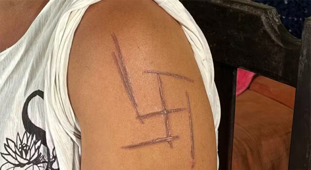 Mulher trans é torturada, ameaçada de morte e marcada com suástica em MS: “Sou marcada por uma maldade humana”