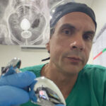 Médico proctologista volta a alertar após novo caso de paciente com plug anal preso: “Pode parecer brincadeira, mas não é”