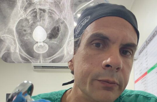 Médico proctologista volta a alertar após novo caso de paciente com plug anal preso: “Pode parecer brincadeira, mas não é”