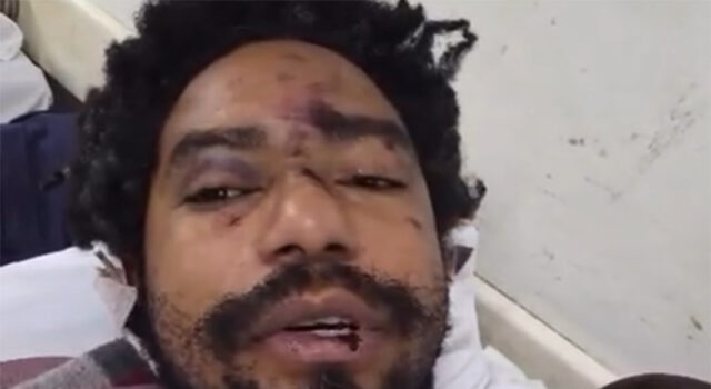 Montado de drag, ator é perseguido e espancado por grupo ao sair de adega no Centro de SP