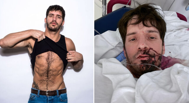 Astro do pornô gay Ty Roderick é esfaqueado e pede ajuda após ataque: “Agora estou com medo”