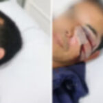Homem é espancado por seis rapazes e denuncia homofobia em Florianópolis: “Pela voz, vi que é gayzinho”