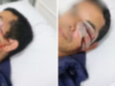Homem é espancado por seis rapazes e denuncia homofobia em Florianópolis: “Pela voz, vi que é gayzinho”