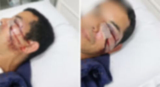 Homem é espancado por seis rapazes e denuncia homofobia em Florianópolis: “Pela voz, vi que é gayzinho”