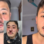 Professor denuncia ataque homofóbico no Metrô de SP e diz que apareceu como vítima e autor do crime em boletim de ocorrência