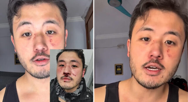 Professor denuncia ataque homofóbico no Metrô de SP e diz que apareceu como vítima e autor do crime em boletim de ocorrência