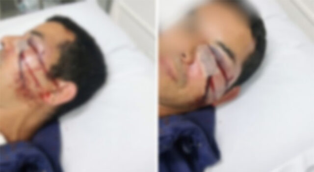 Homem é preso por participação em ataque homofóbico que terminou com vendedor espancado e roubado em SC