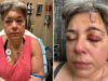 Casal trans é espancado por grupo de 10 pessoas após usar banheiro e acaba preso no lugar dos agressores