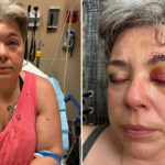 Casal trans é espancado por grupo de 10 pessoas após usar banheiro e acaba preso no lugar dos agressores
