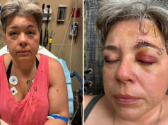 Casal trans é espancado por grupo de 10 pessoas após usar banheiro e acaba preso no lugar dos agressores
