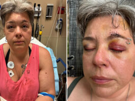 Casal trans é espancado por grupo de 10 pessoas após usar banheiro e acaba preso no lugar dos agressores