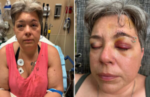 Casal trans é espancado por grupo de 10 pessoas após usar banheiro e acaba preso no lugar dos agressores