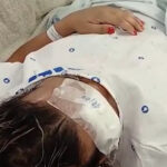 Mulher trans agredida a pauladas e pedradas por três homens em Sepetiba segue internada e aguarda cirurgia no rosto: “Quero justiça”